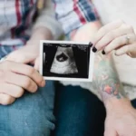 La prima ecografia in gravidanza